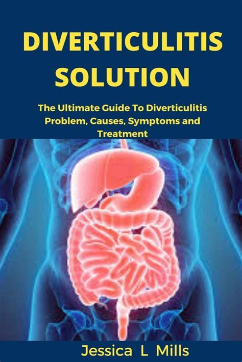 Buy Diverticulitis Solution: The Ultimate Guide to Diverticulitis ...