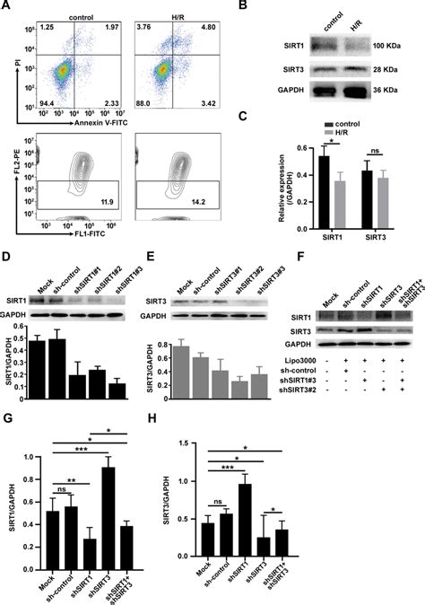 Image result for Coding SIRT