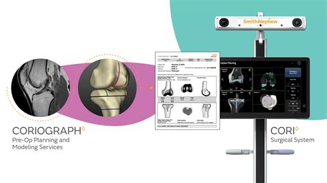 Robotic Knee Surgery Pietermaritzburg - Dr Humza Khan