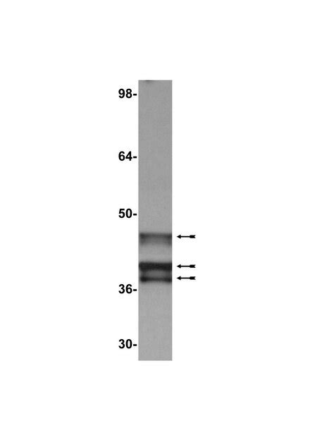 Anti-E1A (Ad2/Ad5) Antibody, clone M73 | 05-599