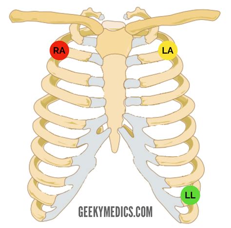 Cardiac Monitoring - OSCE Guide | Telemetry | Geeky Medics