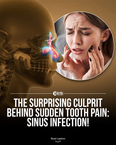 Micris Dental Clinic | Sudden tooth pain? It might not be a cavity! 🤔⁠ ⁠ Sinus infections can ...