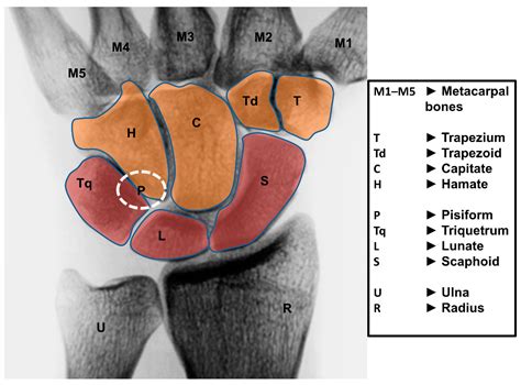 Structural Classification Of Radiocarpal Joint at Isla Lascelles blog