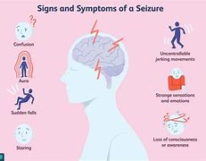Image result for seizures