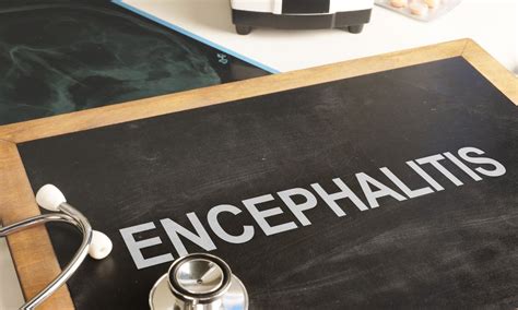 73-Year-Old Defeats Rare NMDA Encephalitis with 5-Day IVIG Treatment at ...