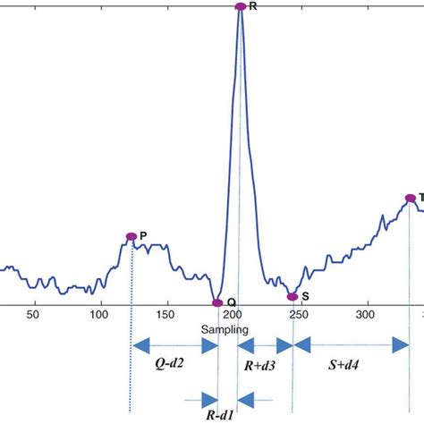Image result for Normal ECG Interval Values