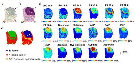 MALDI Mass Spectrometry Imaging Highlights Specific Metabolome and ...