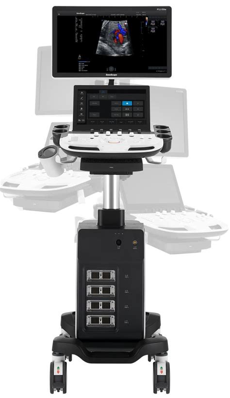 Sonoscape P11 Elite OB Trolley 4D Color Doppler Ultrasound Machine