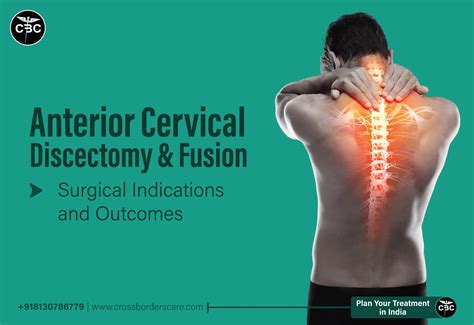 Anterior Cervical Discectomy and Fusion - Indications and Outcomes
