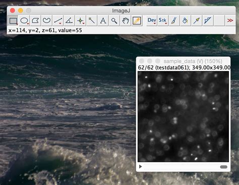Fiji ImageJ Download 的图像结果