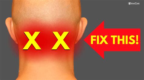 How to Instantly Relieve Neck Pain at the BASE OF THE SKULL