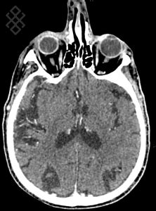 Image result for Scanner Cerebral Avec Injection Diode