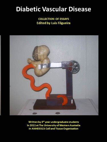 Diabetic Vascular Disease eBook : Price, Imogen, Smith, Ashley, Pantula ...