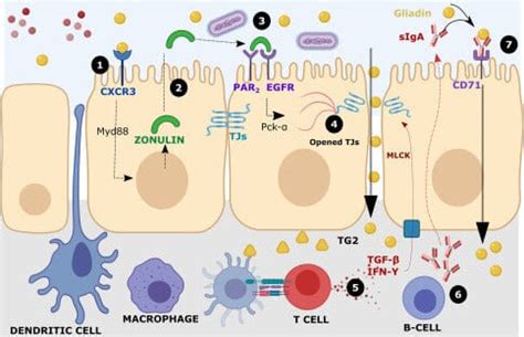 Zonulin in Intestinal Permeability & Autoimmune Diseases – MyDiagnostics