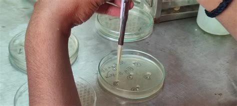 Image result for Agar Plug Diffusion Method