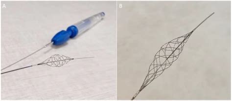 The Stream Device—A Retrospective Review of 51 Cases