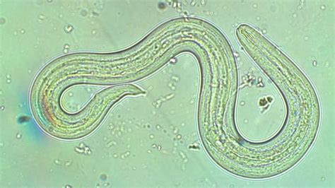 State reports more new cases of rat lungworm disease