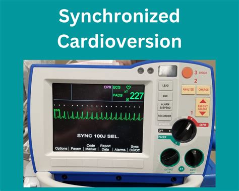 Image result for What Does Synchronized Cardioversion Do