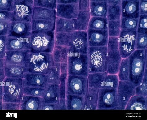 Plant cell mitosis. Light micrograph of root tip cells from an onion ...