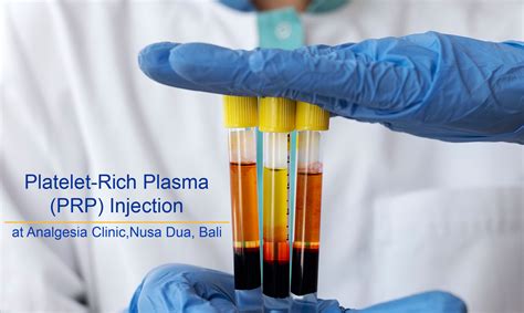 Bali Platelet-rich Plasma Therapy (PRP) - Analgesia Pain Relieve Clinic ...