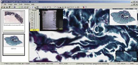 ImageScope Algorithm Software Logo 的图像结果
