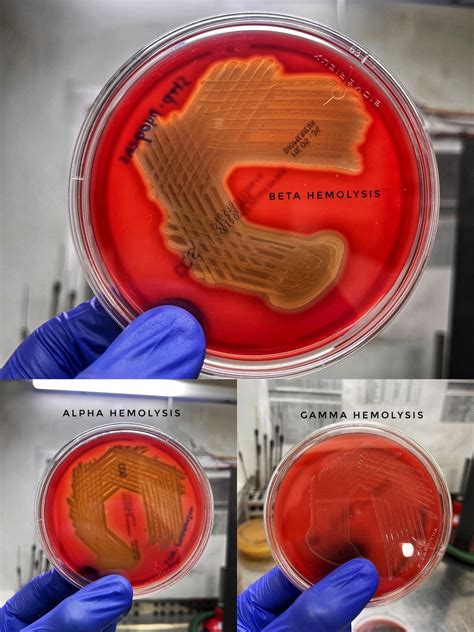 Blood Agar Hemolytic
