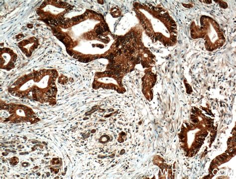 BLK antibody (10510-1-AP) | Proteintech