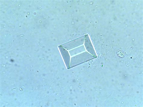 Triple Phosphate Crystals