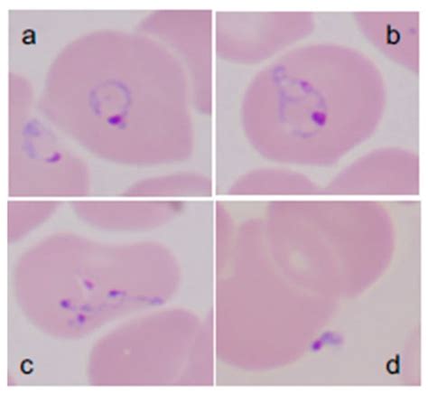 Persistence of Babesia microti Infection in Humans