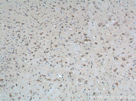 PTEN antibody (22034-1-AP) | Proteintech