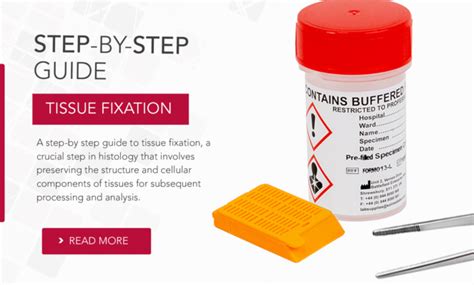 Image result for Tissue Fixation