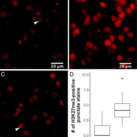 Image result for Prefrontal Cortex Mouse Brain