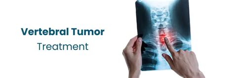 Comprehensive Vertebral Tumor Treatment in Vizag