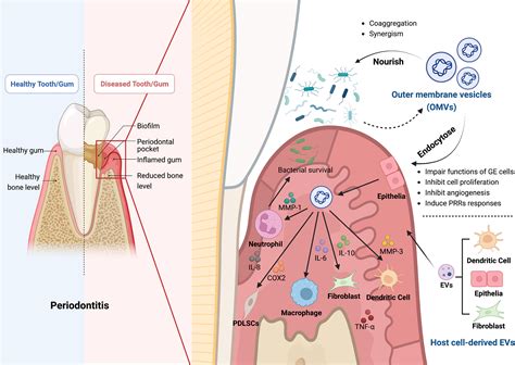 Frontiers | The role of extracellular vesicles in periodontitis: pathogenesis, diagnosis, and ...