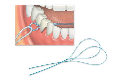 Image result for Using a Floss Threader