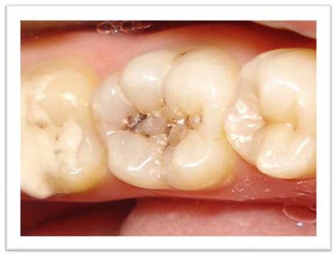 Treatment Rendered - Oradent