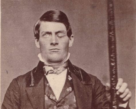 Phineas Gage: Biography, Brain Injury, and Influence