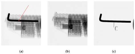 Metallic Artifacts’ Reduction in Microtomography Using the Bone- and ...