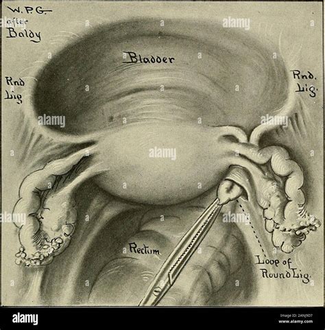 Ovary Anatomy Ligament