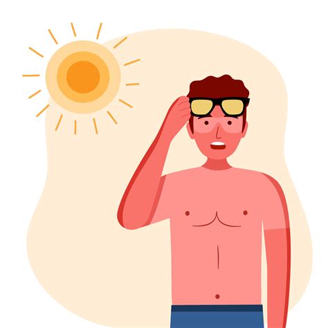 Sunburn Clip Art