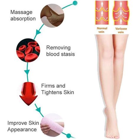 Buy 20g Varicose Veins Cream Varicosity Angiitis Remedy Ointment Relief ...