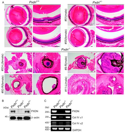 Biallelic Deletion of Pxdn in Mice Leads to Anophthalmia and Severe Eye ...