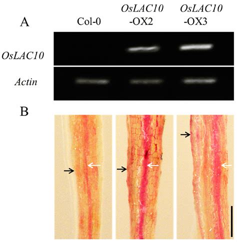 Comprehensive Analysis of Rice Laccase Gene (OsLAC) Family and Ectopic ...