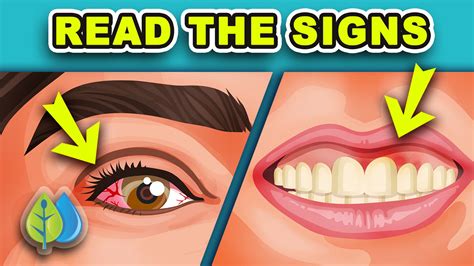 Signs And Symptoms Of Vitamin A Deficiency at Dean Metoyer blog