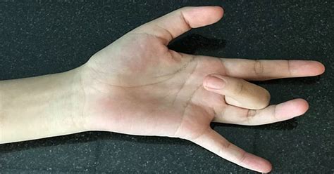 Finger Spring 的图像结果