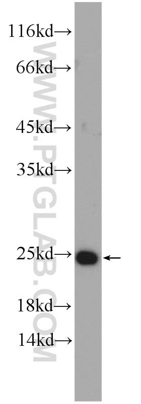 IL1F10 antibody (21530-1-AP) | Proteintech