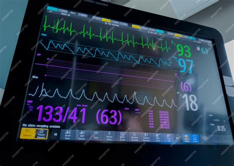 El monitor del hospital muestra los signos vitales, la frecuencia ...