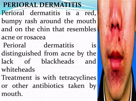 Dermatitis slide | PDF