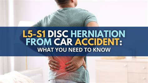 Disc Herniation L5 S1