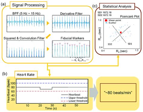 Image result for Heart Rhythm Monitoring Algorithm